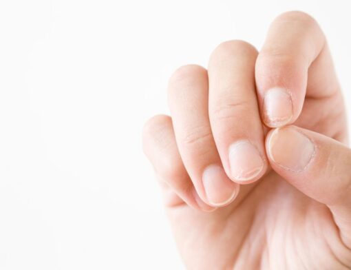 unhas quebradiças